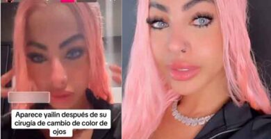Yailin 'La más viral' muestra sus nuevos ojos
