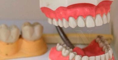 Prótesis dentales