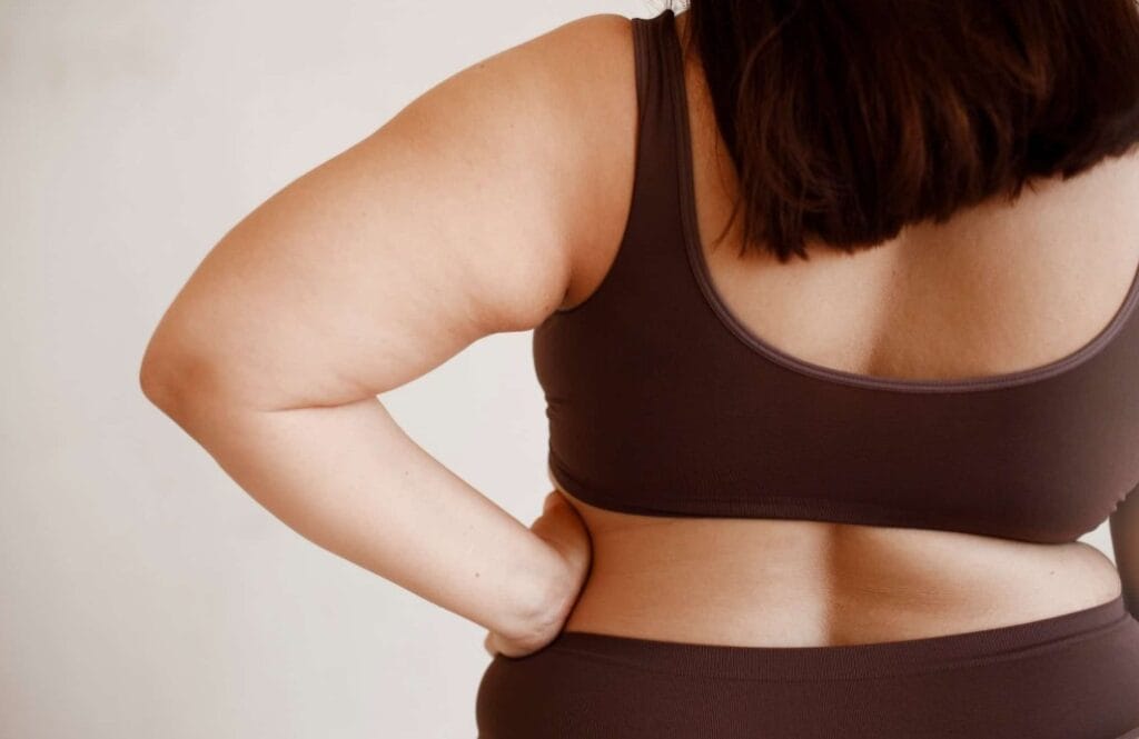 Especialista alerta que la obesidad provoca más de 200 complicaciones de salud