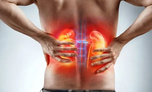 Día Mundial del Cáncer de Riñón: los síntomas que muchas personas confunden con otras enfermedades