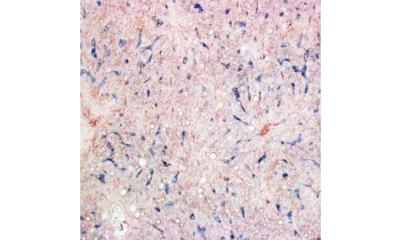 Los mecanismos que permiten esa orientación en palomas permanecían desconocidos hasta un reciente estudio internacional Crédito: Lisowski et al. (2026) Science