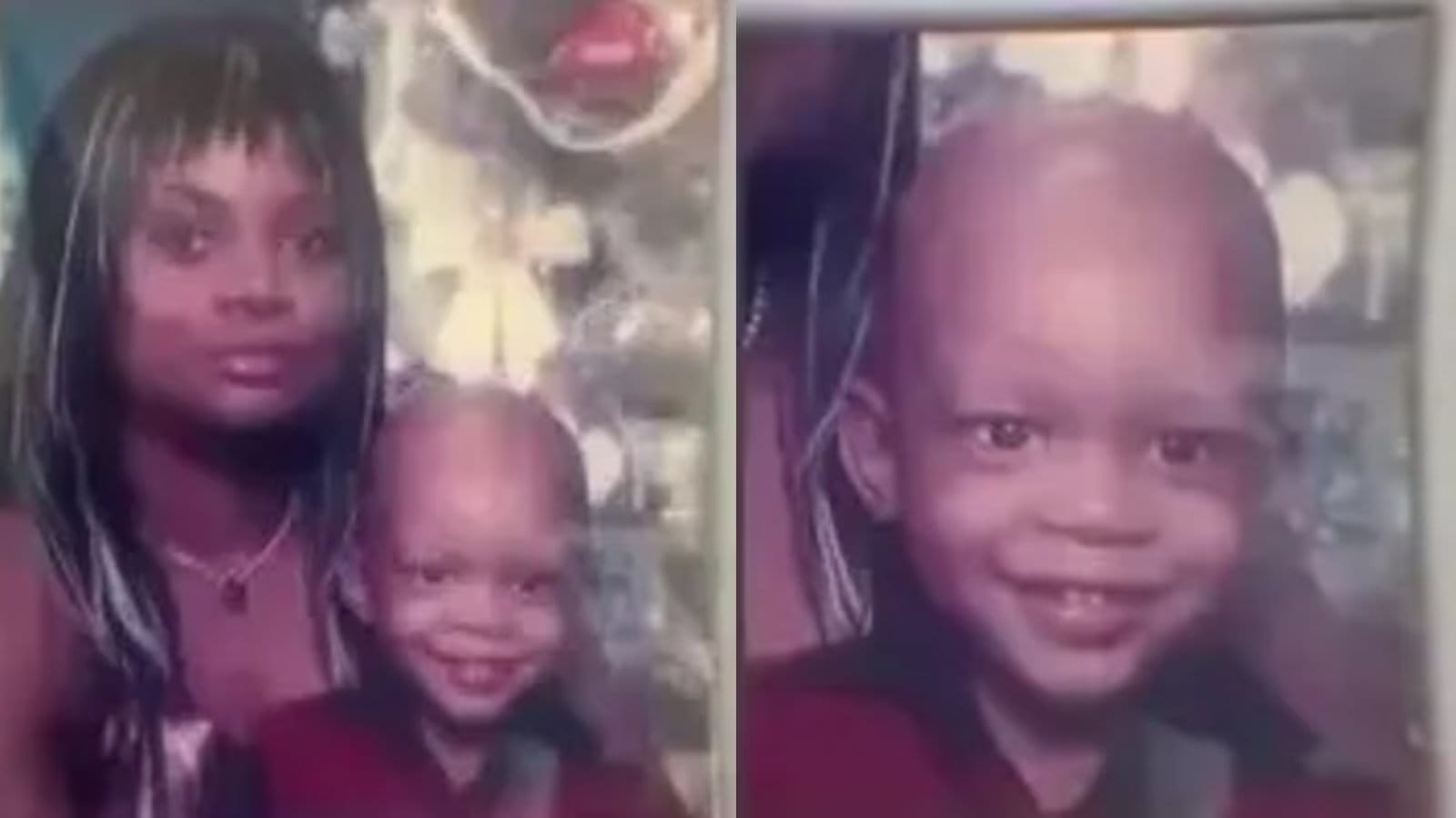 Jayden Nelson super&oacute; un c&aacute;ncer de c&eacute;lulas germinales a los 18 meses, una enfermedad que se extendi&oacute; a sus pulmones y que los m&eacute;dicos consideraban potencialmente mortal (Cr&eacute;dito: Instagram)
