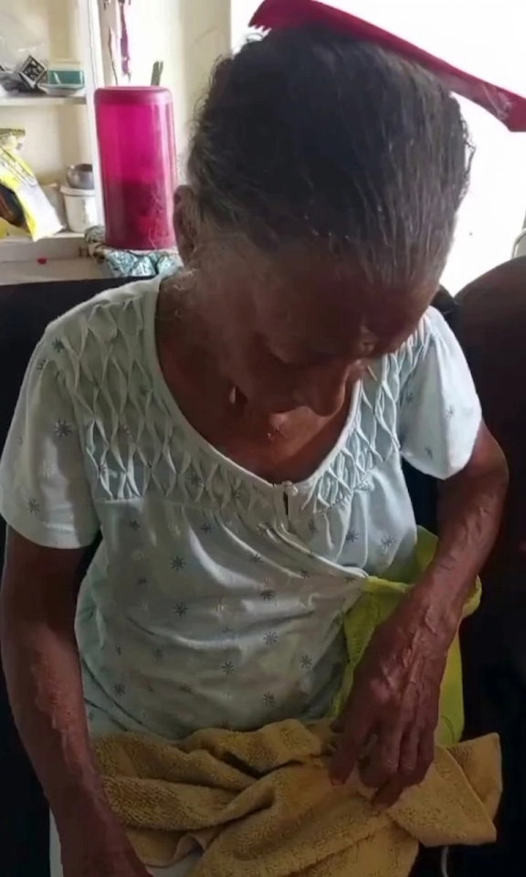 Doña afectada mostrando las heridas que le dejo el joven