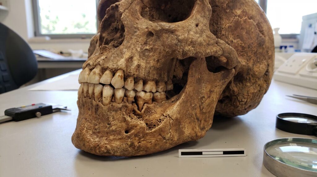 Hallan en Israel la evidencia de violencia más antigua en un fósil humano de 90.000 años