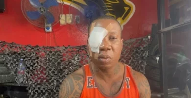 Hombre resulta severamente afectado tras conflicto con individuo en Jacagua