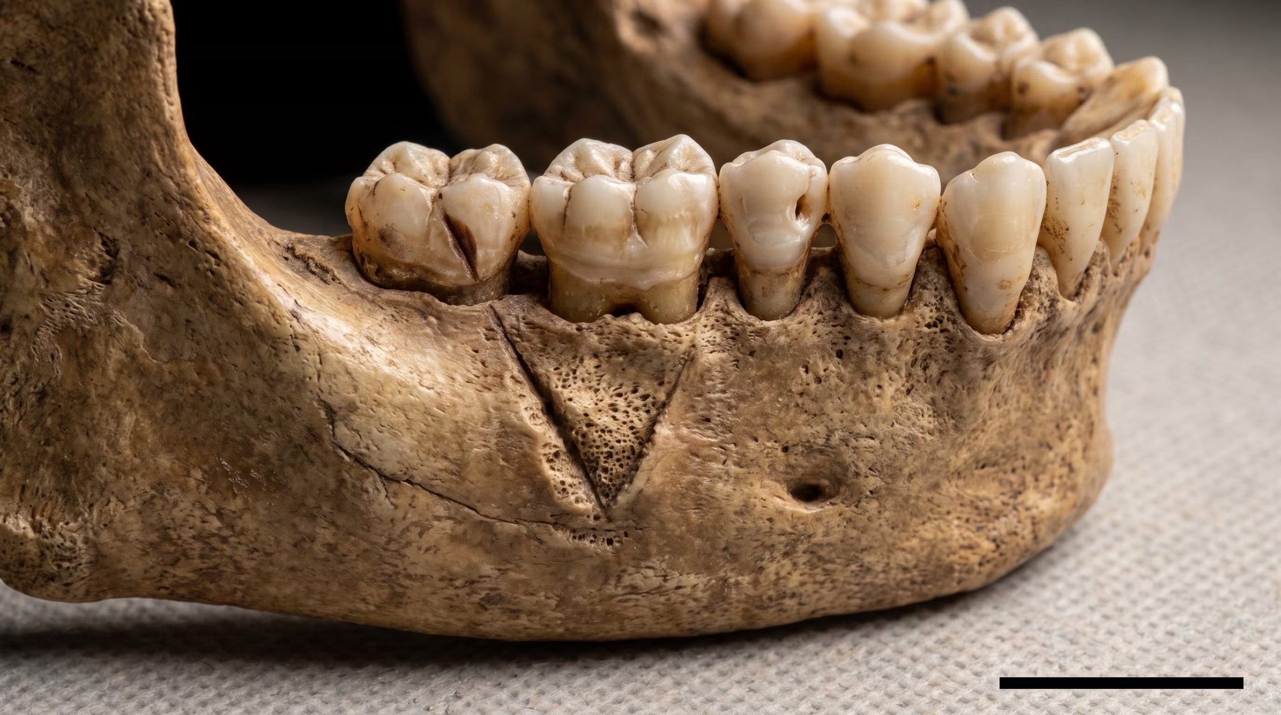 La mandíbula fósil de Qafzeh 25, hallada en Israel, muestra una herida compatible con un traumatismo por objeto cortante hace más de 90.000 años, indicando posible violencia interpersonal. (Imagen Ilustrativa Infobae)