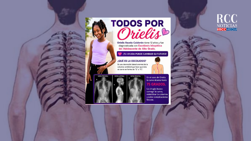 Familia de niña con escoliosis severa solicita ayuda para cubrir cirugía de RD$1 millón