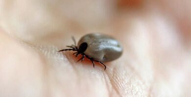 Estadounidense contrae un virus poco común para el que no existe ni vacuna ni tratamiento