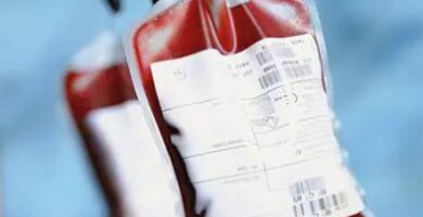 Se necesita con urgencia sangre A para paciente que será sometida a cirugía de corazón abierto