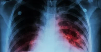Tuberculosis latente: qué significa, por qué no contagia y cuándo puede convertirse en enfermedad activa