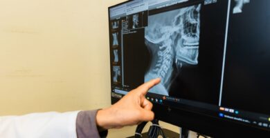 Menor ingiere cinco imanes y los expulsa en hospital de EsSalud